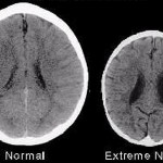 nature versus nurture in developing brains 